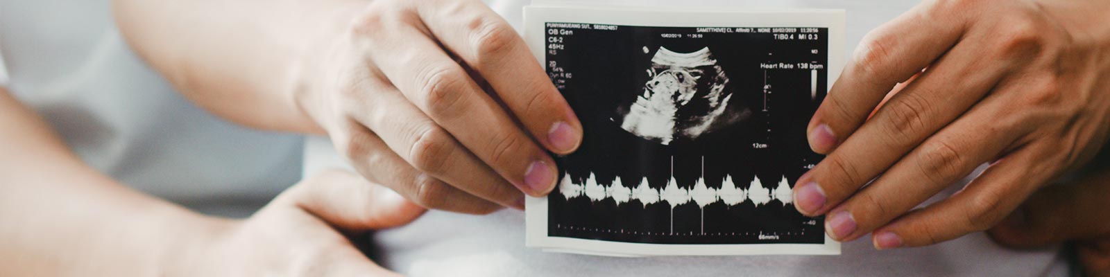 Diagnóstico y Tratamiento de Embarazos de Alto Riesgo